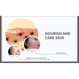 Foto 4 | Crema Hidratante Para El Acné Huoguo Para Rostro 30 G - Venta Internacional.