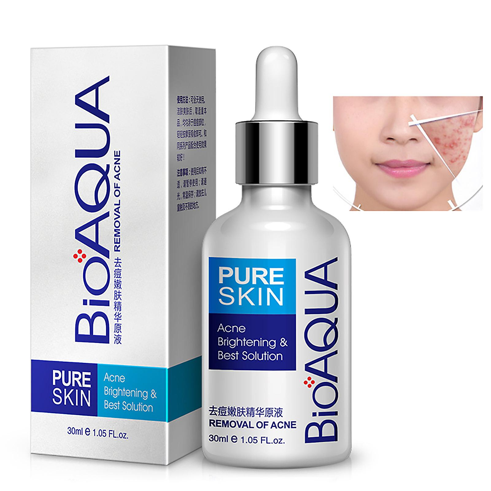 Foto 6 pulgar | Crema Hidratante Para El Acné Huoguo Para Rostro 30 G - Venta Internacional.