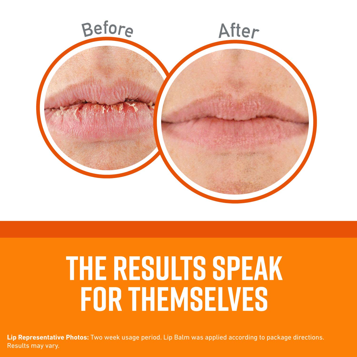 Foto 3 pulgar | Bálsamo Labial O'keeffe's Lip Repair Para Labios Secos Y Agrietados, Paquete De 3 - Venta Internacional.