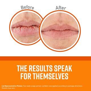 Foto 2 | Bálsamo Labial O'keeffe's Lip Repair Para Labios Secos Y Agrietados, Paquete De 3 - Venta Internacional.