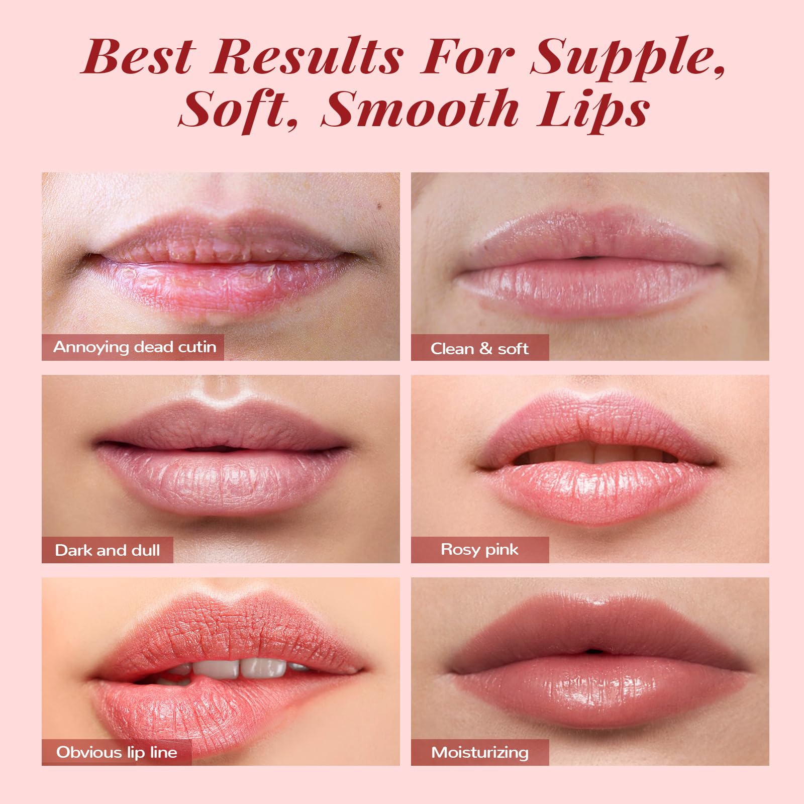 Foto 6 | Set De Bálsamo E Hidratante Para Labios Anai Rui Exfoliante Y Mascarilla Labial - Venta Internacional.