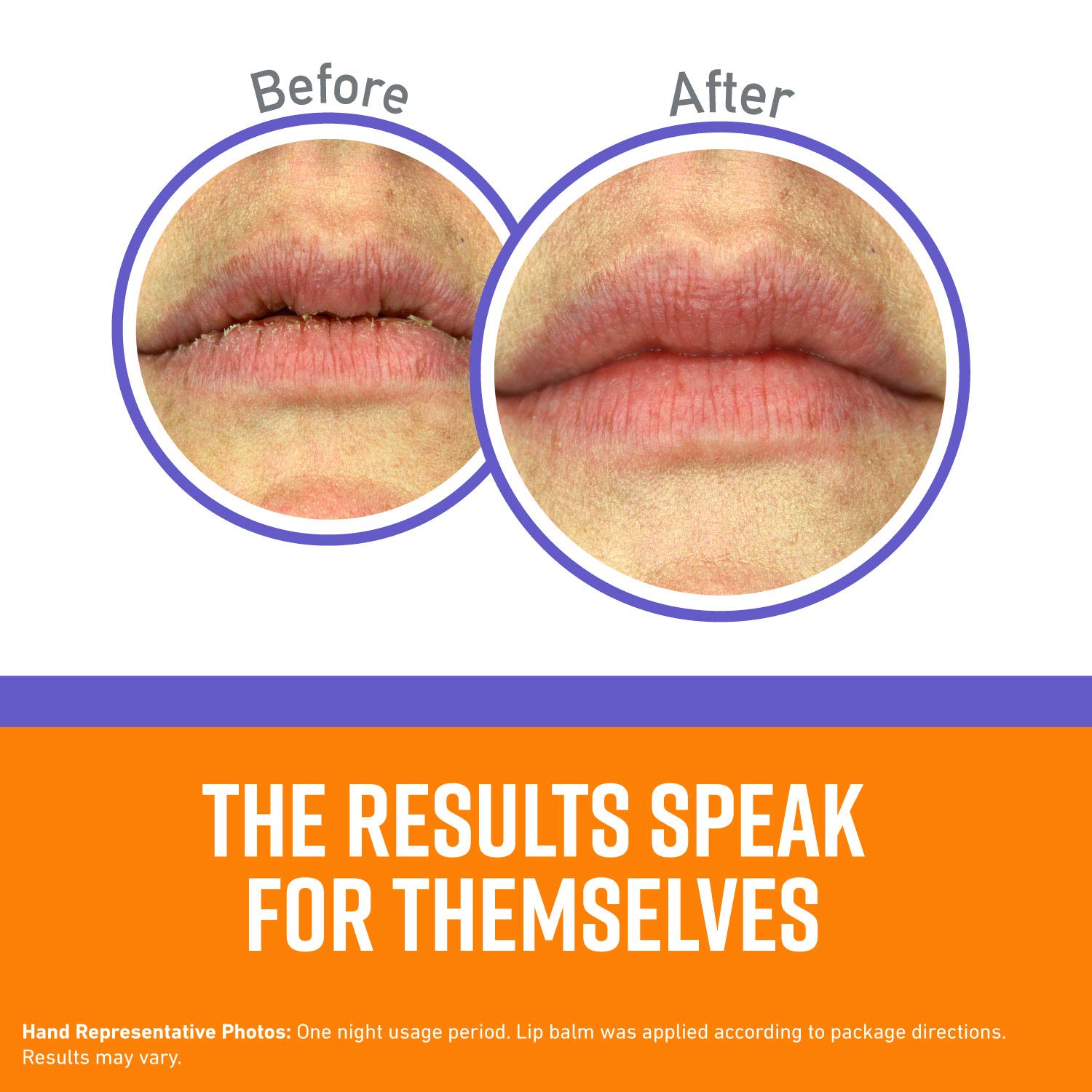 Foto 3 pulgar | Lip Balm O'keeffe's Lip Repair Night Treatment 7 Ml (paquete De 2) - Venta Internacional.