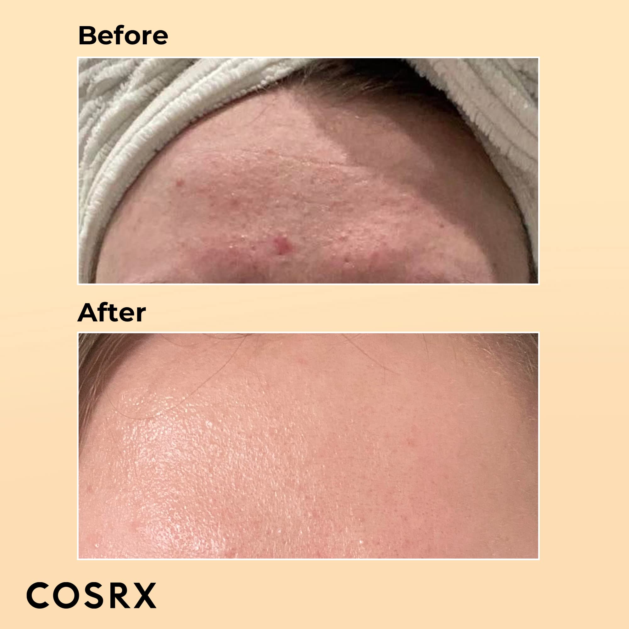 Foto 3 | Sérum Hidratante Cosrx Snail Mucin 96% Power Repair 100 ml - Venta Internacional