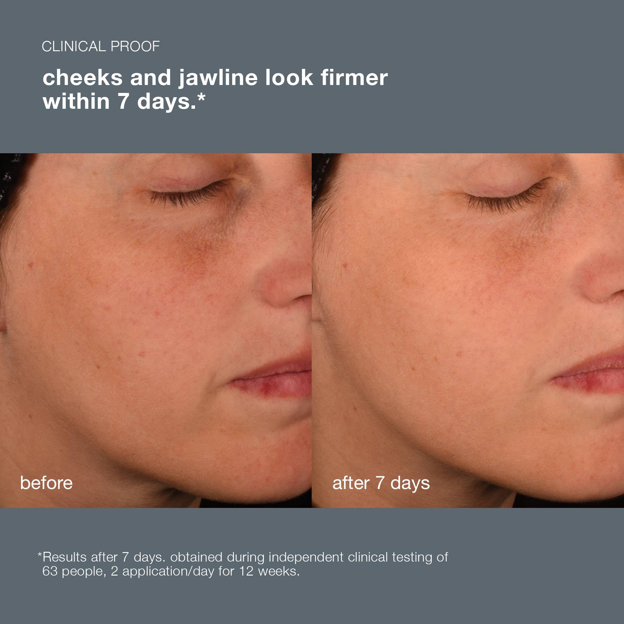 Foto 6 | Serum Dermalogica Pro Collagen Banking 30 Ml Para Rostro - Venta Internacional.