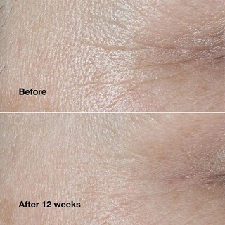 Foto 3 | Crema Facial Clinique Smart Clinical Repair Wrinkle 50 ml - Venta Internacional