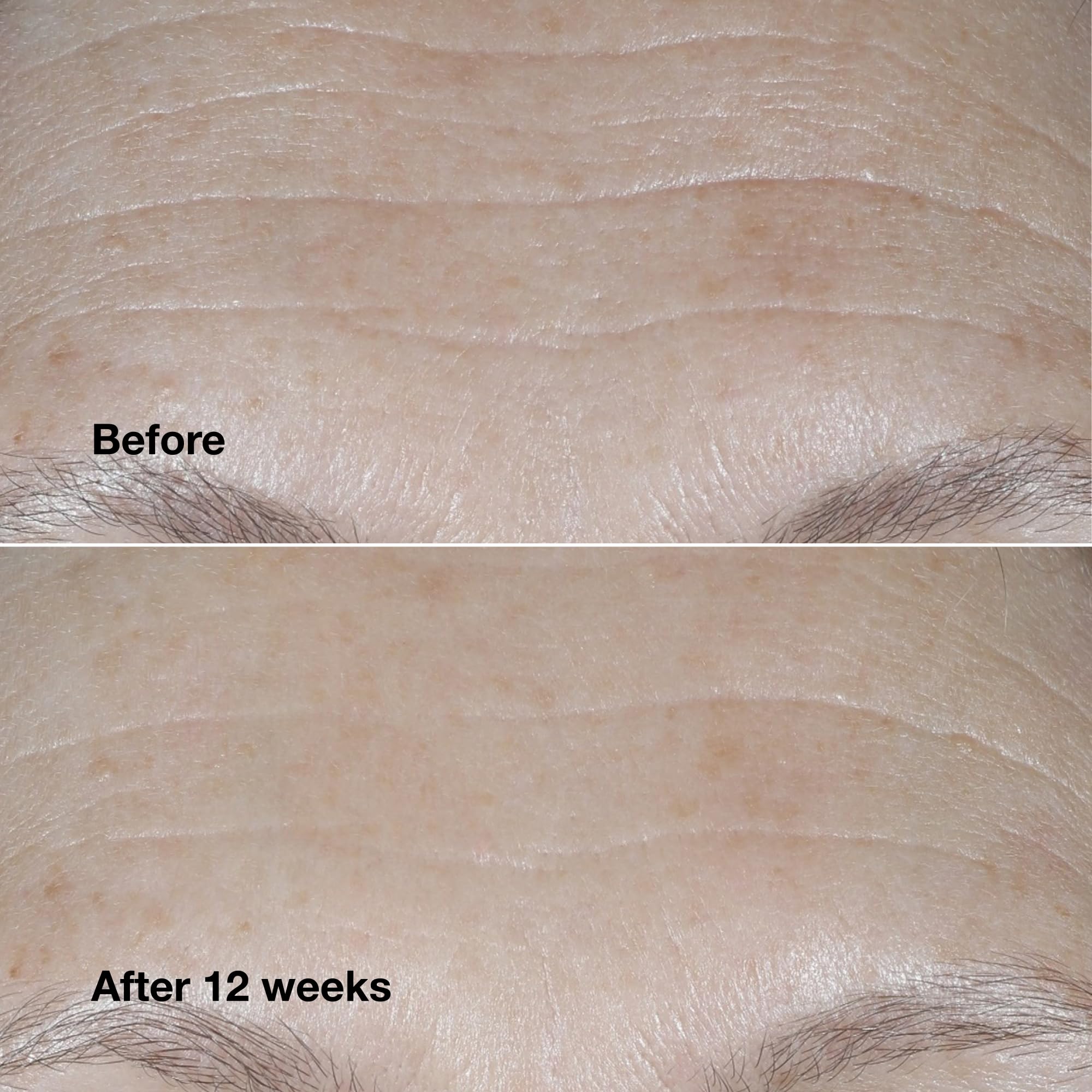 Foto 4 | Crema Hidratante Clinique Smart Clinical Repair Spf 30 - Venta Internacional