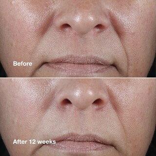 Foto 4 | Crema Facial Clinique Smart Clinical Repair Wrinkle 50 Ml - Venta Internacional