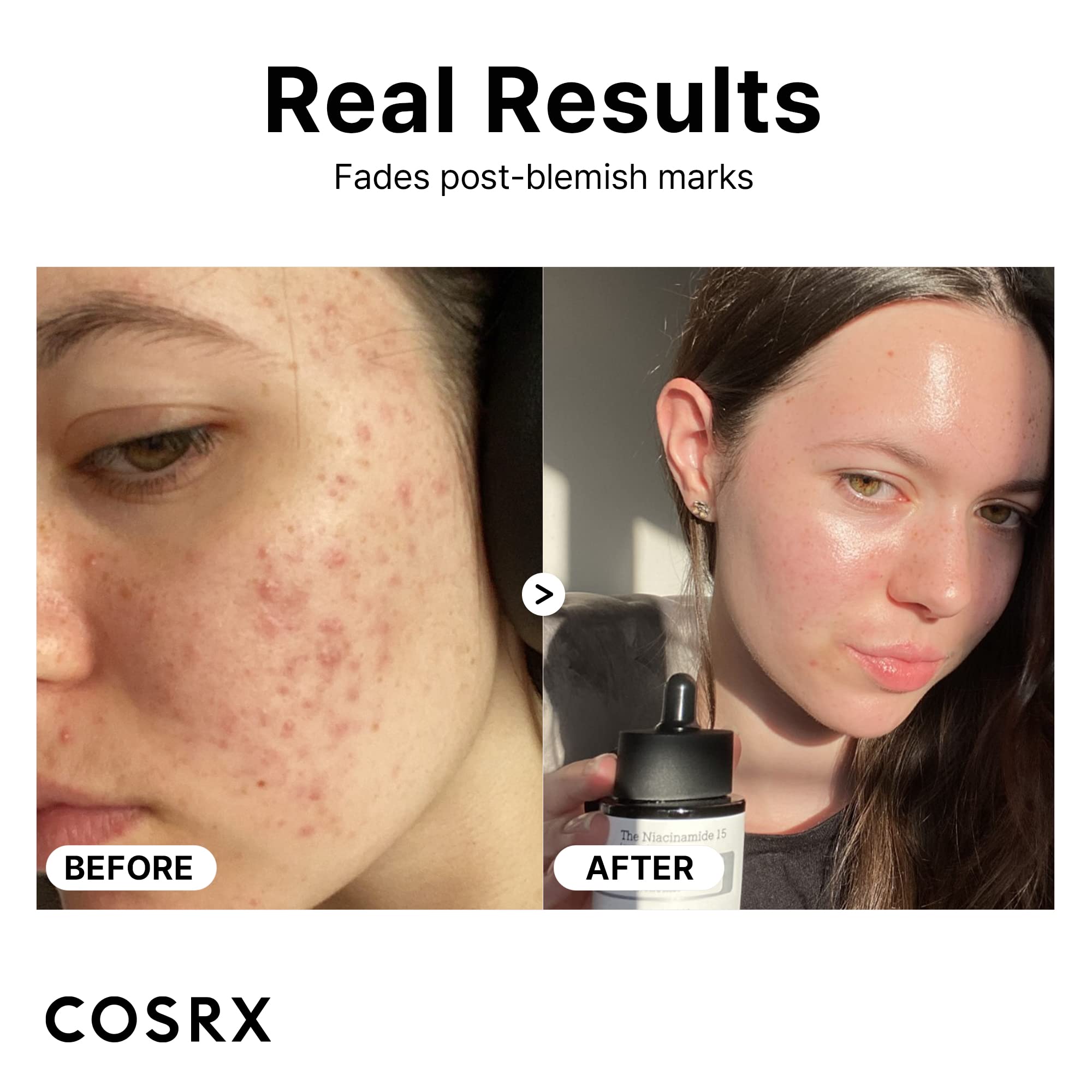 Foto 5 pulgar | Sérum Facial Cosrx con Niacinamida al 15% para Minimizar Poros y Suavizar la Piel 20 ml - Venta Internacional