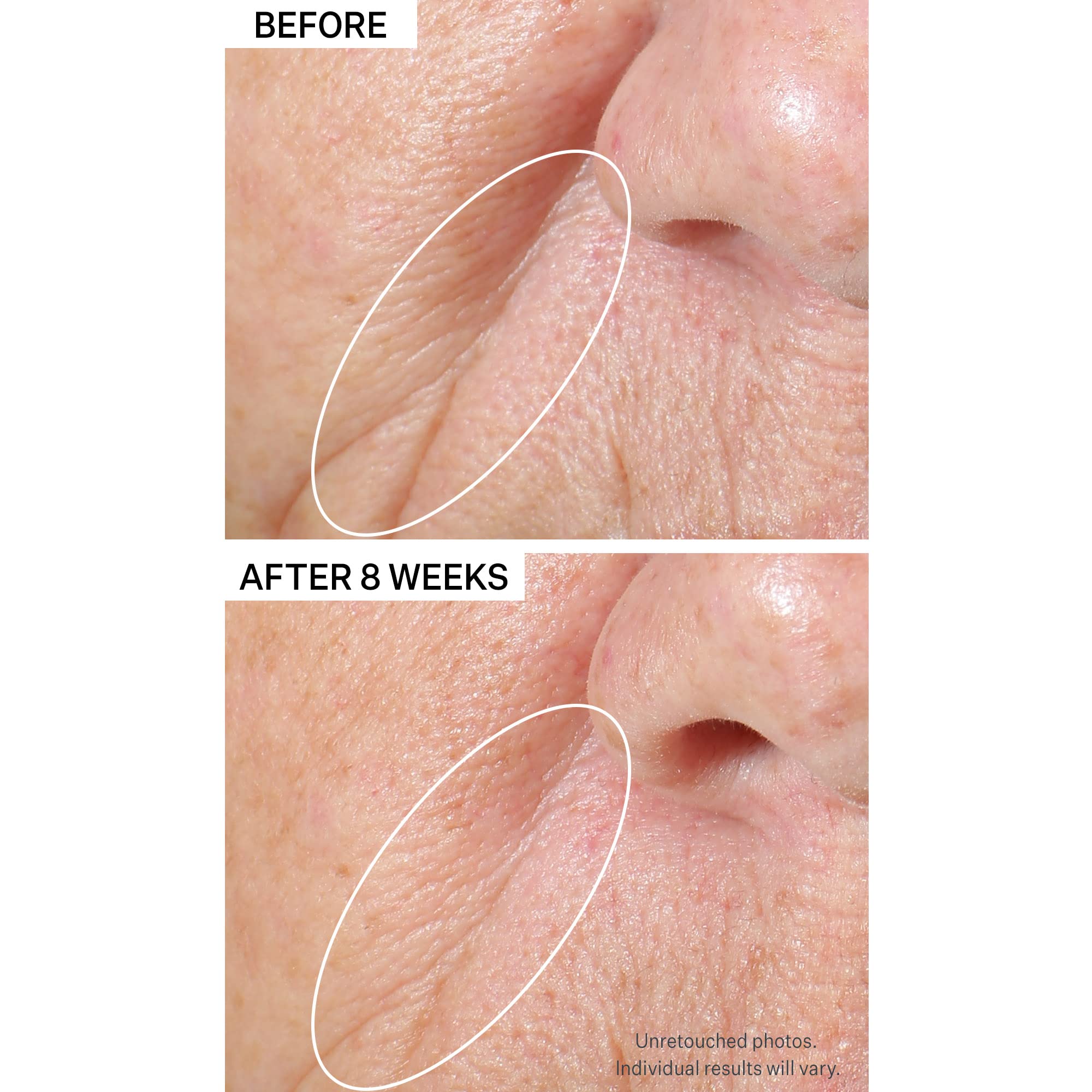 Foto 3 | Sérum Strivectin Tighting & Lift Peptight Para Reafirmar E Iluminar - Venta Internacional.