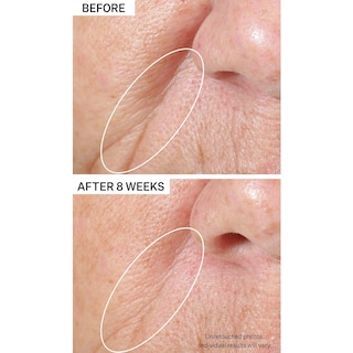 Foto 3 | Sérum Strivectin Tighting & Lift Peptight Para Reafirmar E Iluminar - Venta Internacional.
