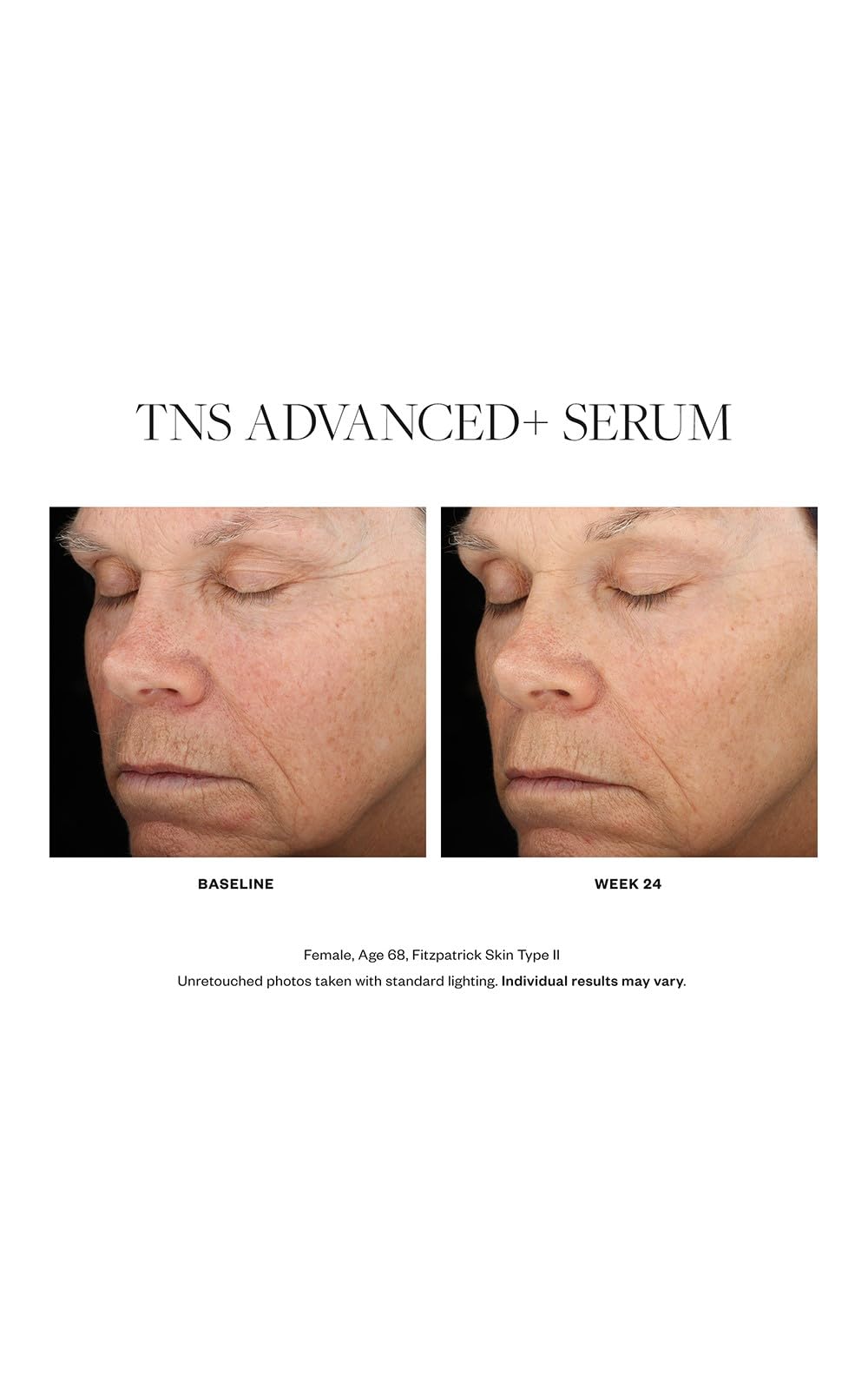 Foto 6 pulgar | Serum Skinmedica Tns Advanced+ 30 Ml Antienvejecimiento Para Mujeres - Venta Internacional.