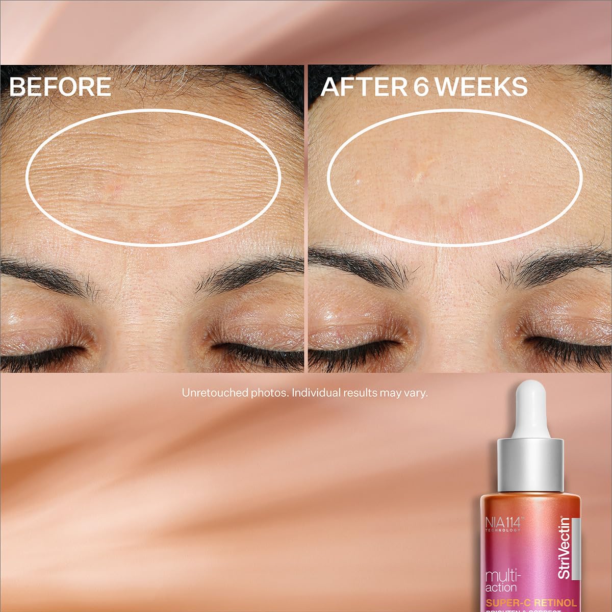 Foto 7 pulgar | Sérum Facial Strivectin Multi-action Super-c Retinol 30 Ml - Venta Internacional.