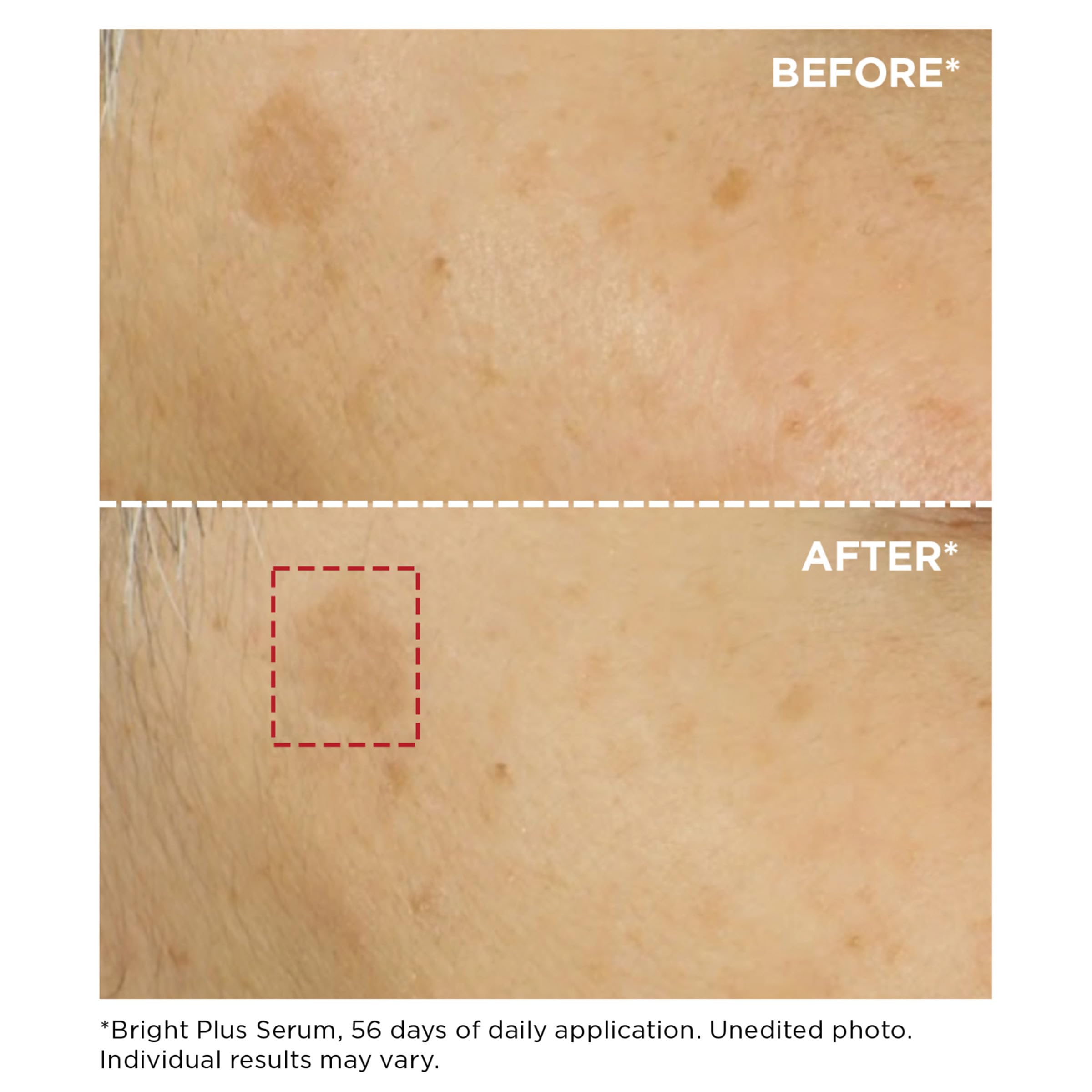 Foto 4 pulgar | Sérum Clarins Bright Plus Que Ilumina Visiblemente Las Manchas Oscuras, 30 Ml - Venta Internacional.
