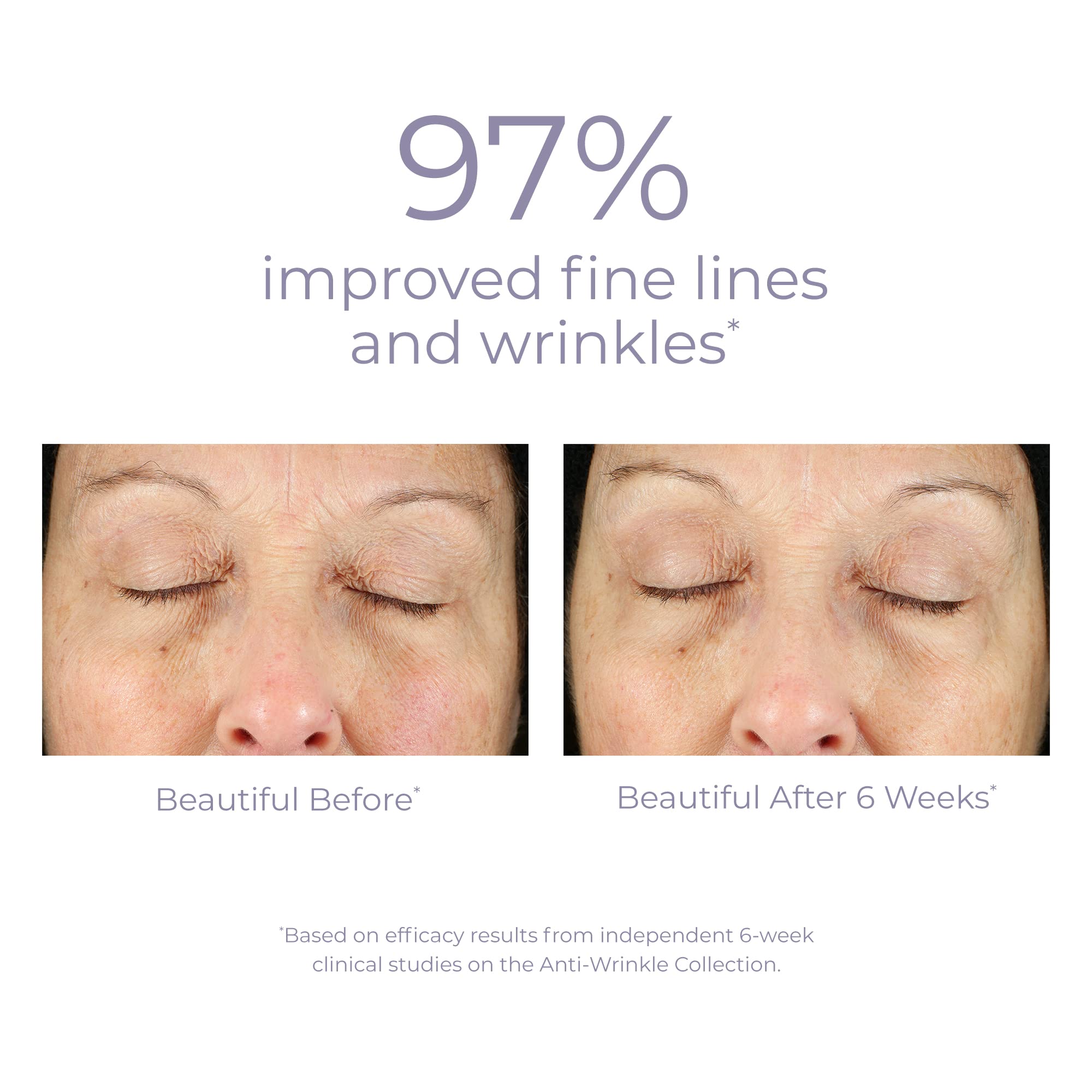 Foto 5 | Sérum Derma E Con Retinol Antiarrugas De 30 Ml Para Un Brillo Juvenil - Venta Internacional.