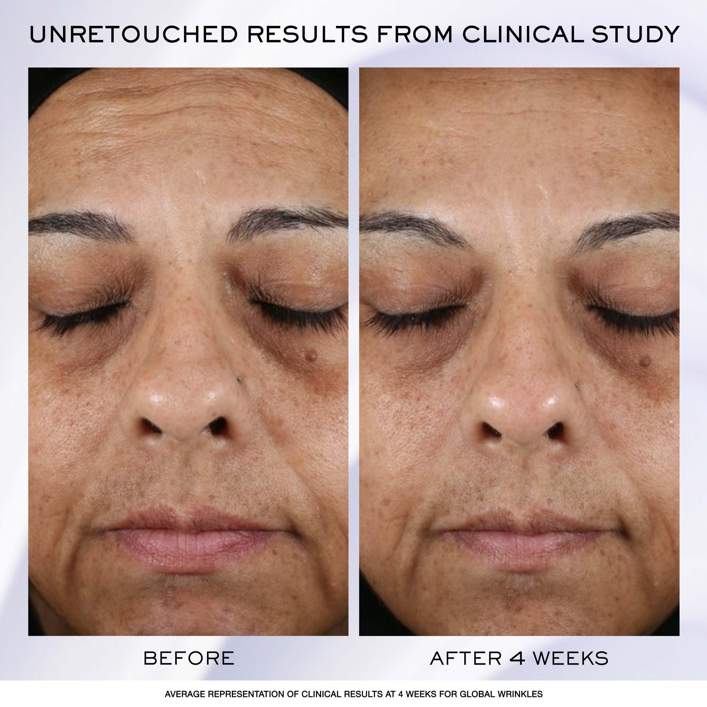 Foto 5 pulgar | Crema Facial Lancôme Rénergie H.p.n 300 Péptidos 30 Ml Con Ácido Hialurónico Y Niacinamida - Venta Internacional.
