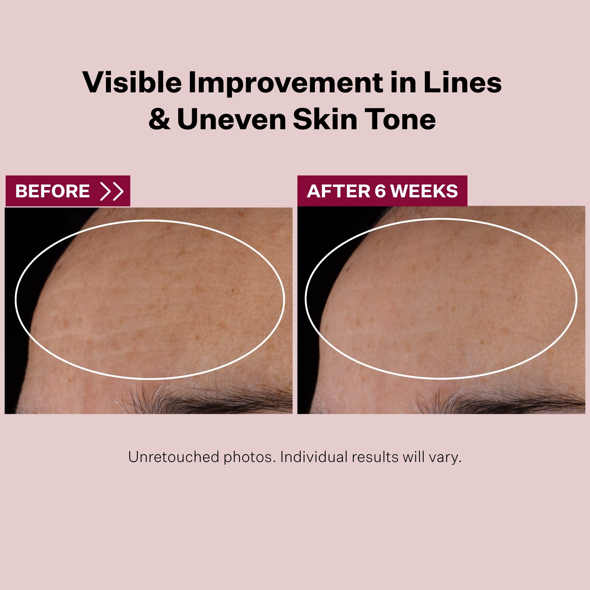 Foto 4 pulgar | Sérum Strivectin Advanced Retinol Multi-correct Nocturno - Venta Internacional