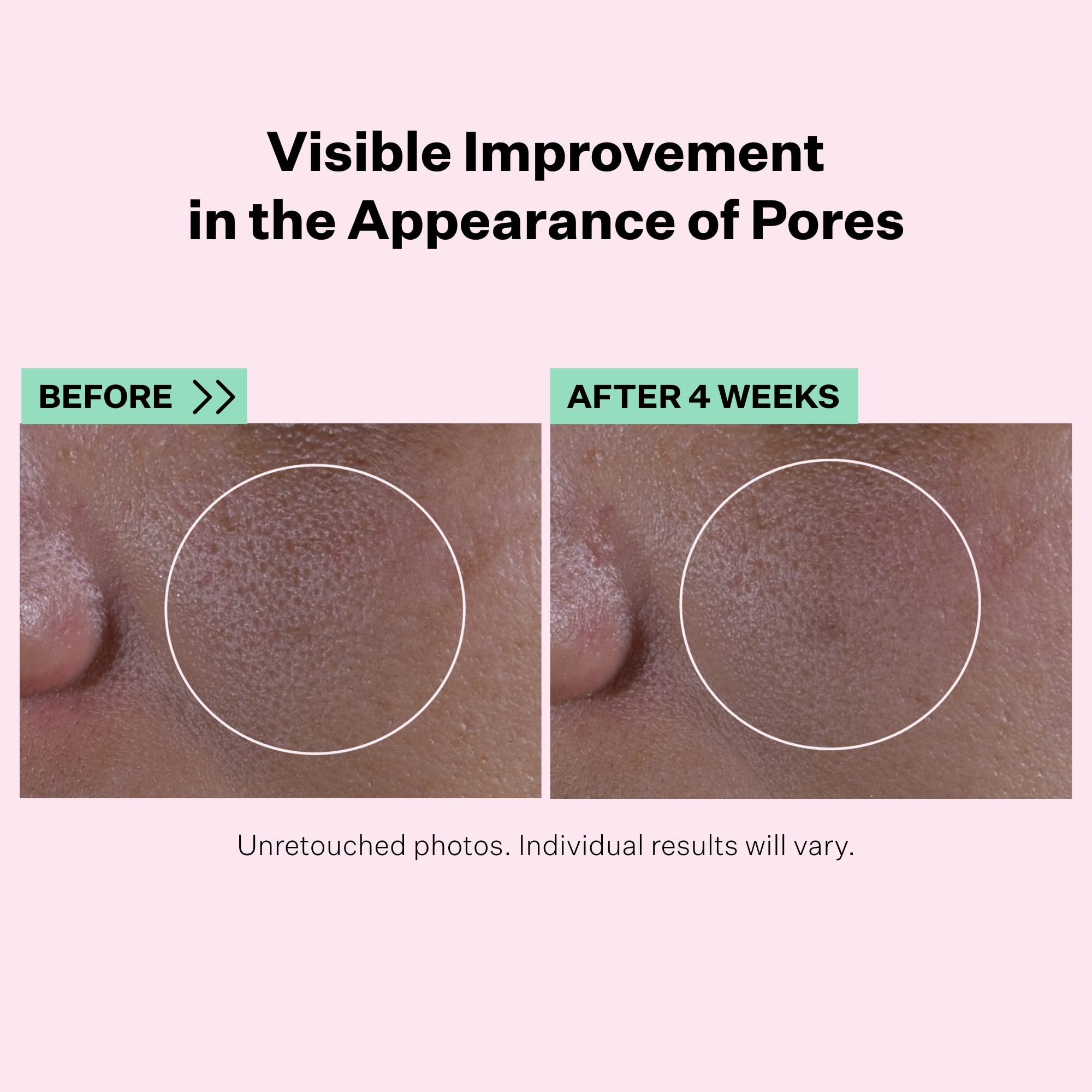 Foto 4 pulgar | Sérum Strivectin Multi-action Super Shrink Que Minimiza Los Poros - Venta Internacional.