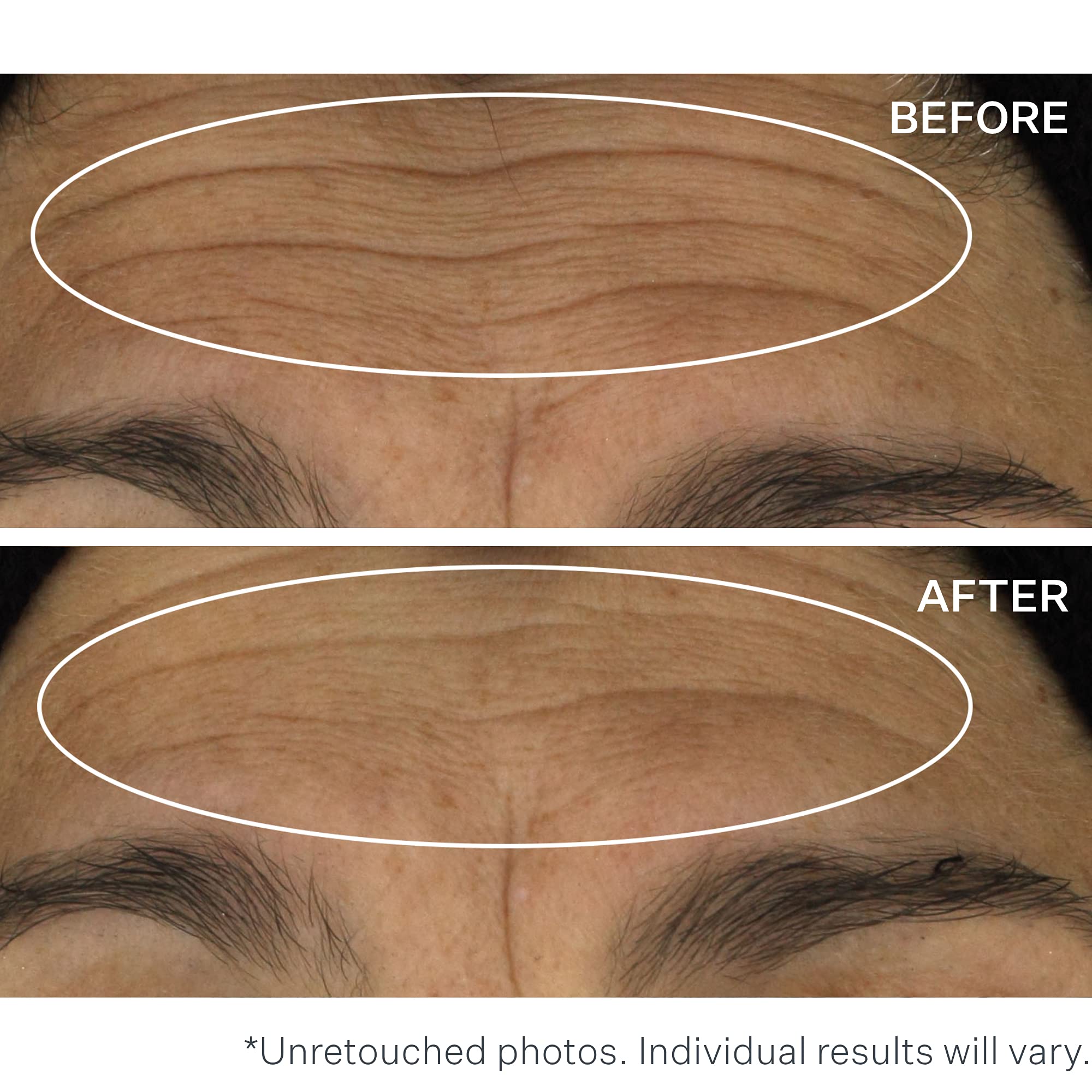 Foto 7 pulgar | Sérum Strivectin Wrinkle Recode Line Transforming 30 Ml - Venta Internacional.
