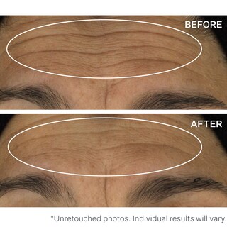 Foto 6 | Sérum Strivectin Wrinkle Recode Line Transforming 30 Ml - Venta Internacional.