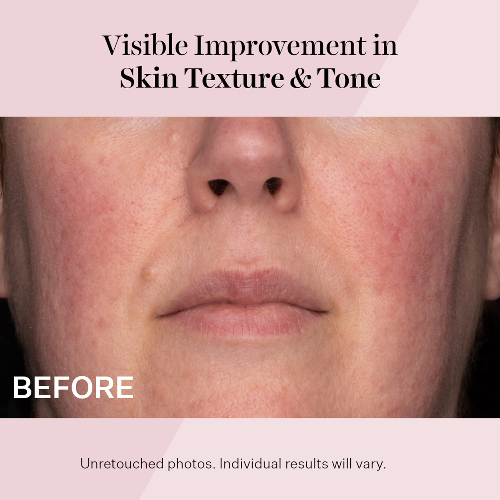 Foto 6 pulgar | Crema Hidratante Strivectin Advanced Retinol Spf 30 50 Ml - Venta Internacional.