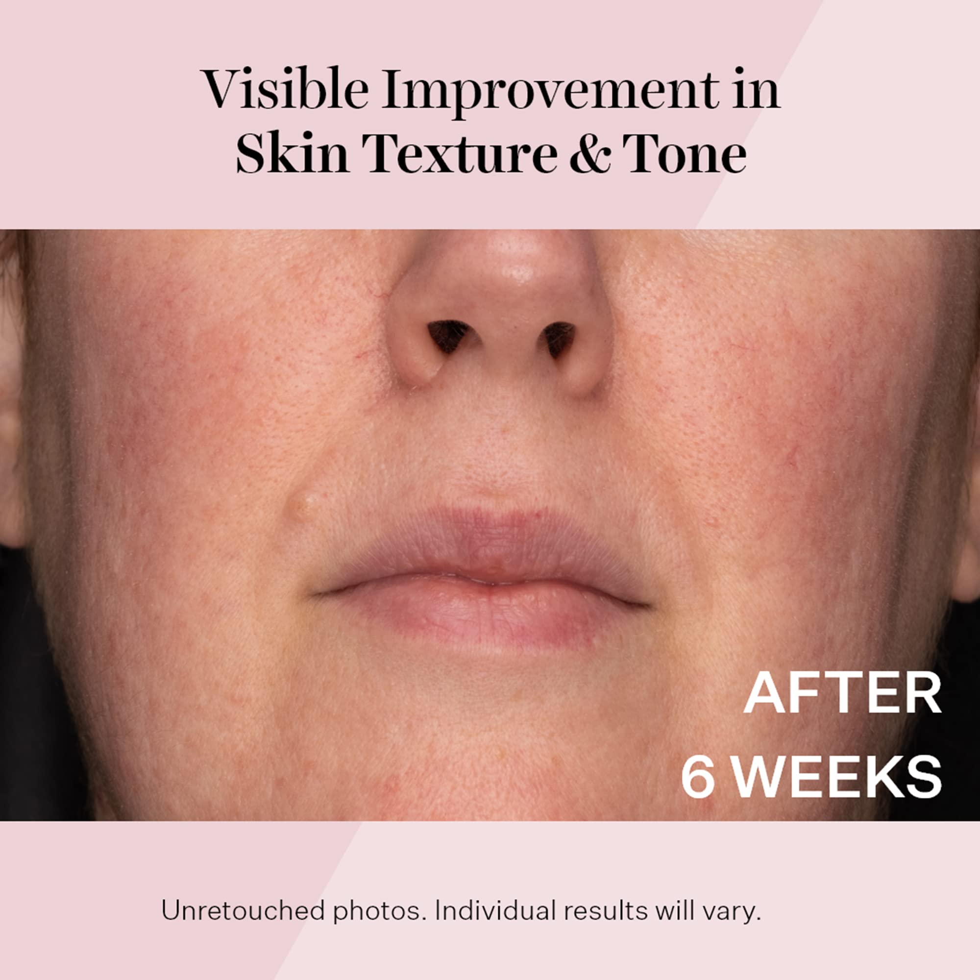 Foto 8 pulgar | Crema Hidratante Strivectin Advanced Retinol Spf 30 50 Ml - Venta Internacional.