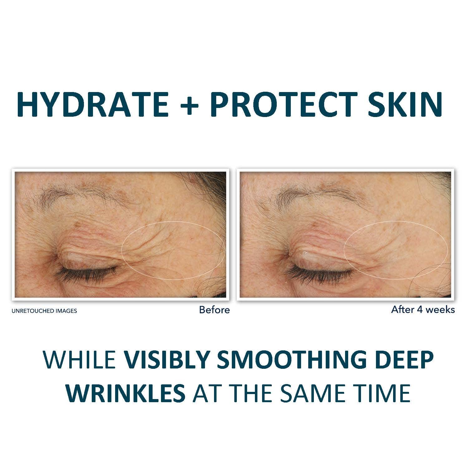 Foto 4 pulgar | Crema Hidratante Roc Retinol Correxion Deep Wrinkle Spf30 30 Ml - Venta Internacional.