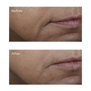 Foto 4 | Face Lift Perricone Md Éster de Vitamina C Iluminador 59 ml - Venta Internacional