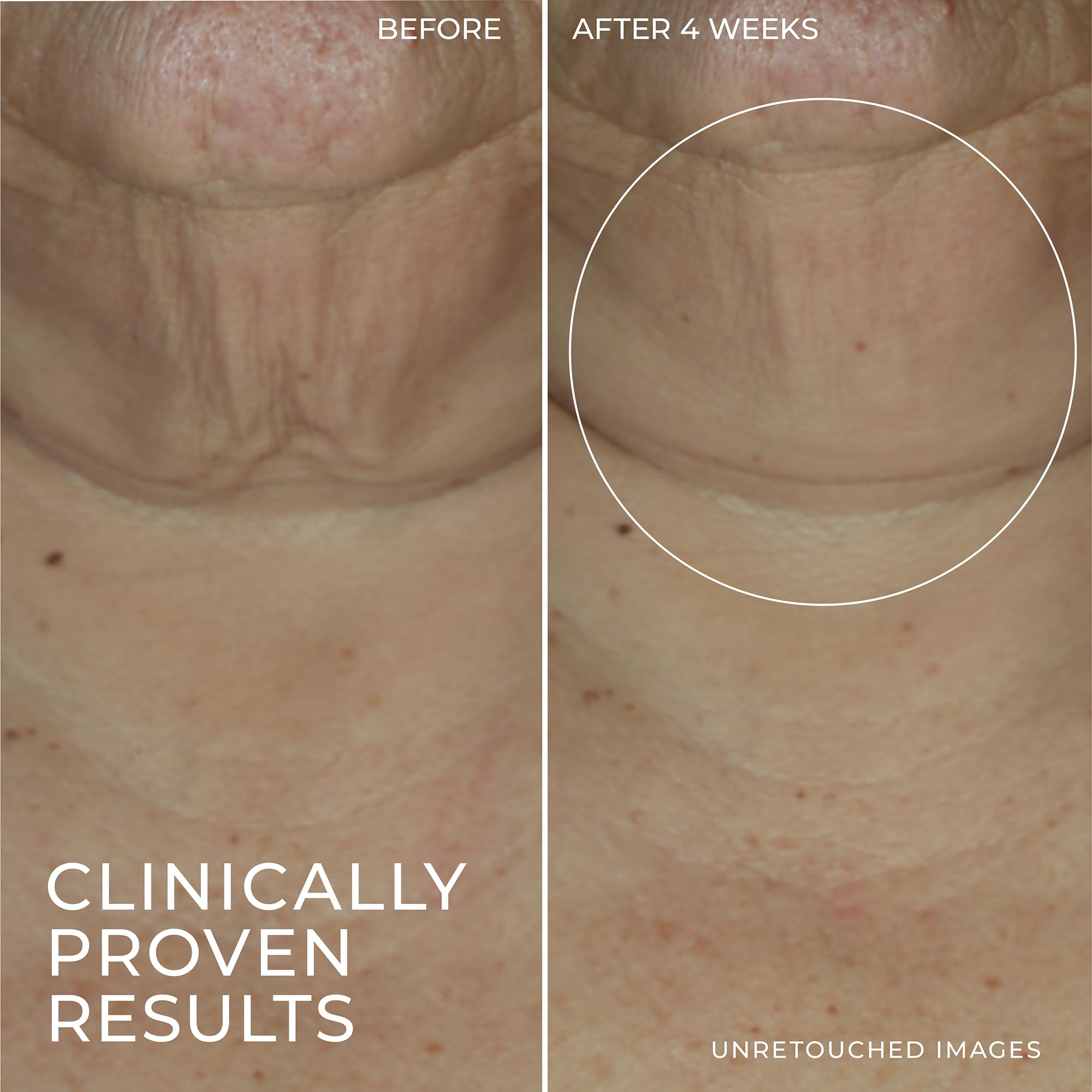 Foto 7 pulgar | Sérum En Barra Roc Derm Correxion Advanced Retinol Reafirmante 30 Ml - Venta Internacional.