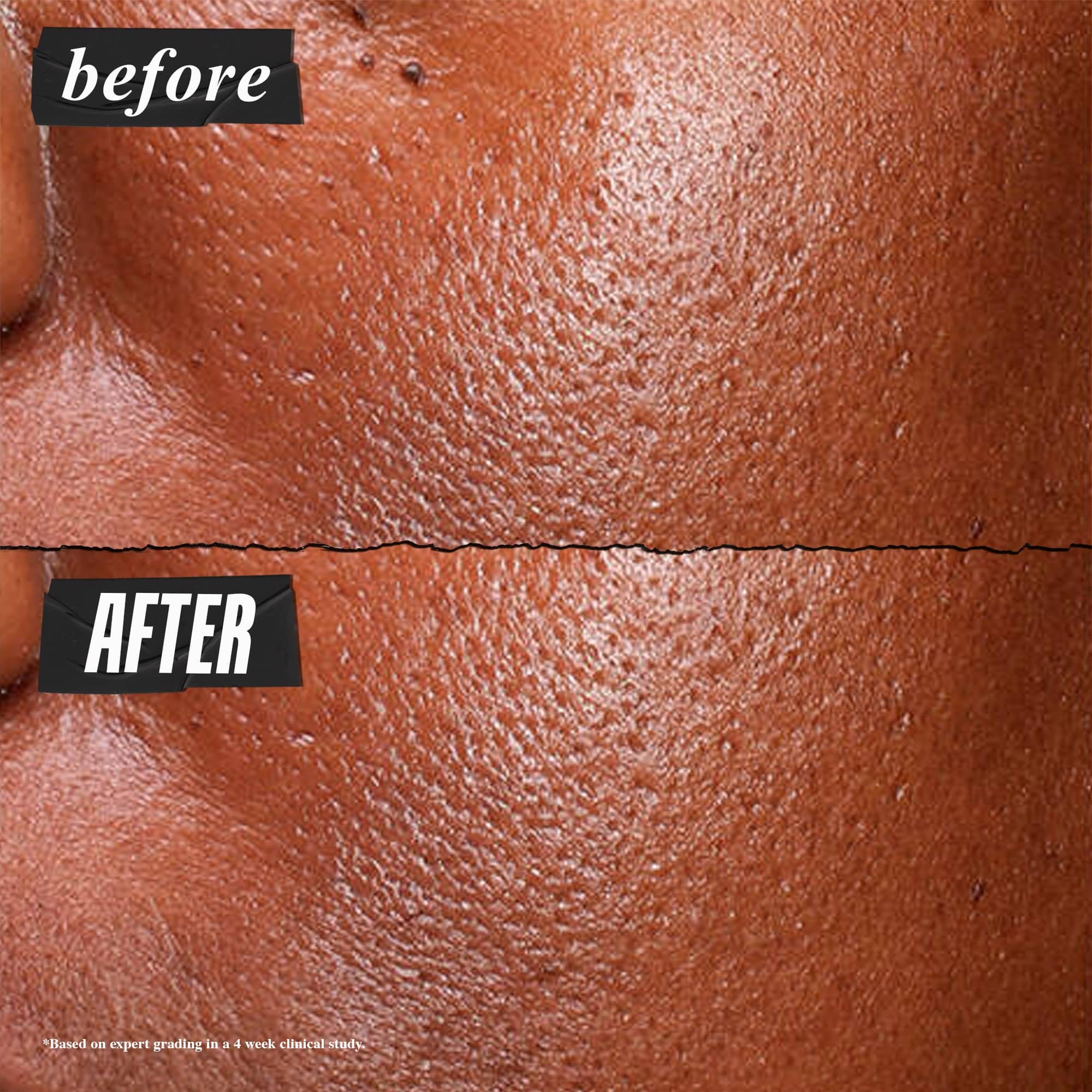 Foto 4 pulgar | Sérum Kiehl's Ultra Pure De Alta Potencia Con Niacinamida Al 5,0%, 30 Ml - Venta Internacional.
