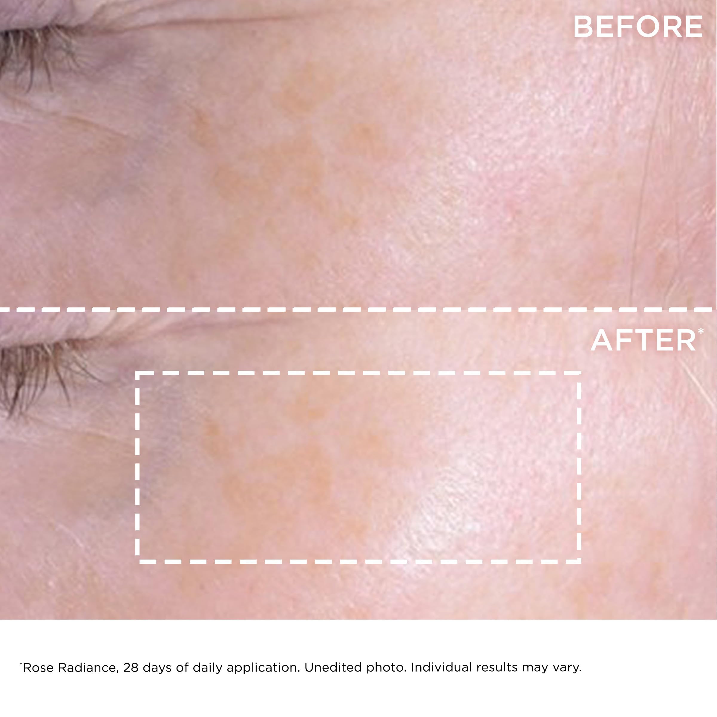 Foto 4 pulgar | Crema Hidratante Clarins Super Restorative Rose Radiance 50 Ml - Venta Internacional.