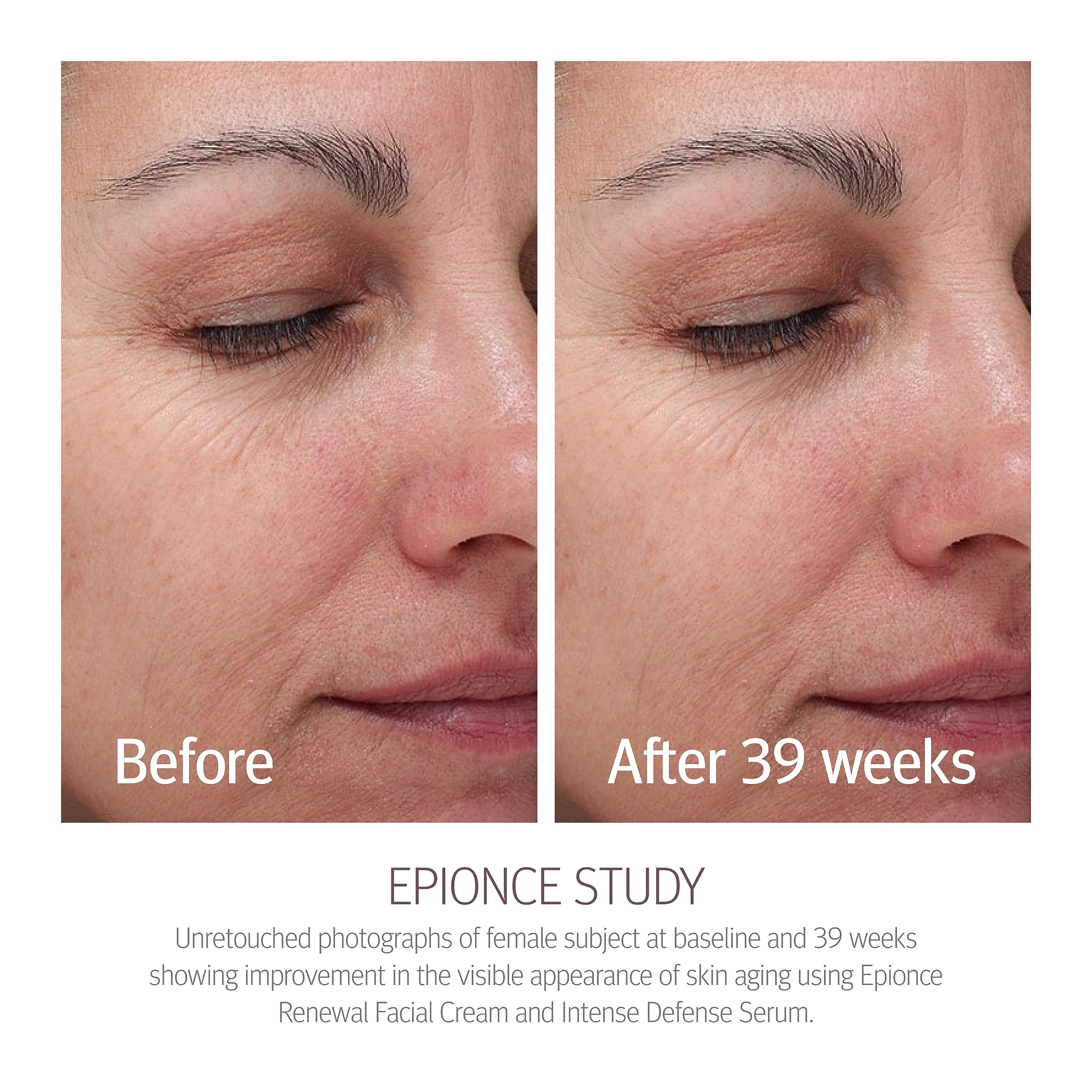 Foto 4 pulgar | Crema Facial Renovadora Epionce Hidratante Antienvejecimiento Para Piel Seca - Venta Internacional.