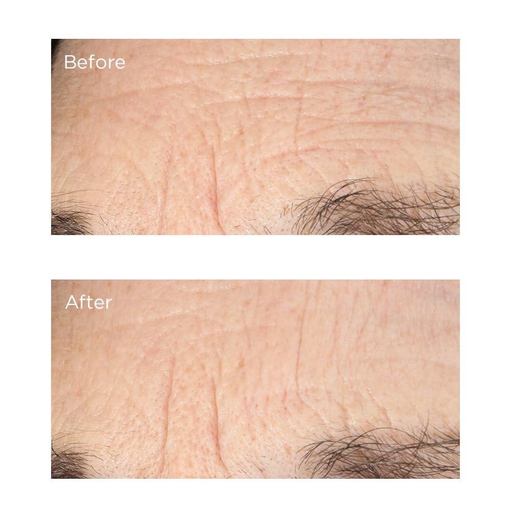 Foto 5 pulgar | Sérum Perricone Md Essential Fx Con Acil-glutatión, Pliegue Profundo - Venta Internacional.