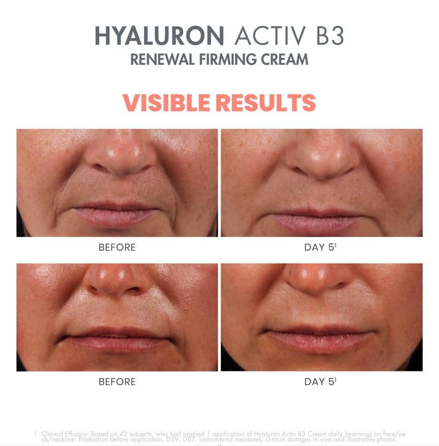 Foto 7 pulgar | Crema Avene Eau Thermale Hyaluron Activ B3, Renovadora Y Reafirmante, 50 Ml - Venta Internacional.