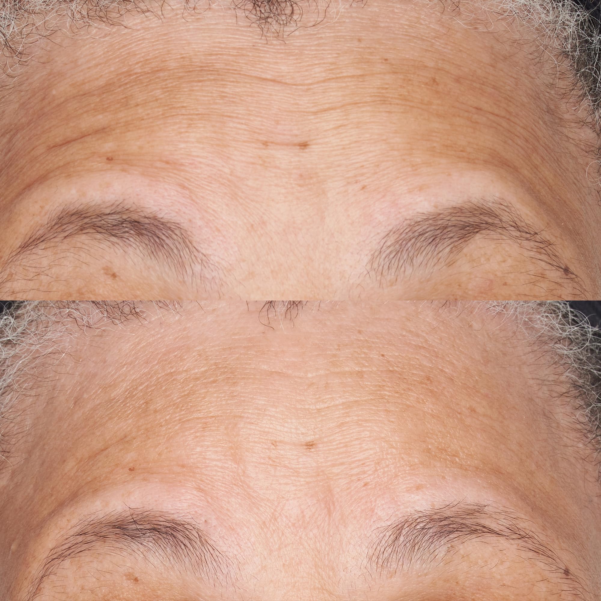 Foto 4 pulgar | Crema Hidratante Perricone Md, Hipoalergénica, Limpia Y Correctora, 60 Ml - Venta Internacional.