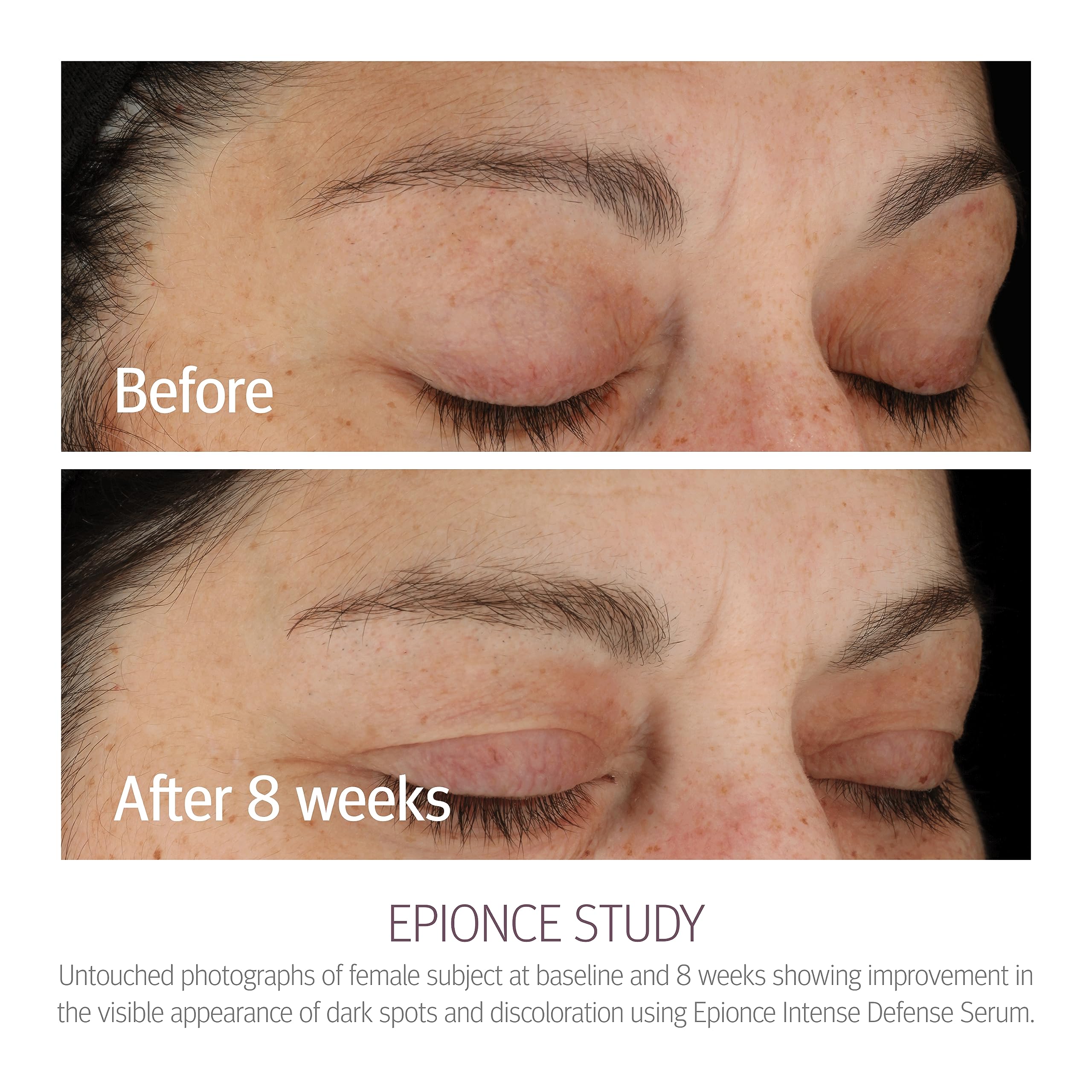Foto 3 | Sérum Antiedad Epionce Intense Defense Con Vitamina Abcde - Venta Internacional.