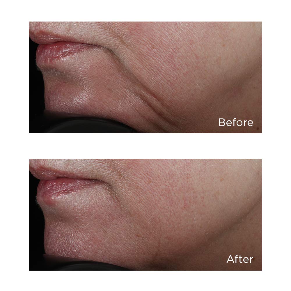 Foto 6 pulgar | Sérum Reafirmante Facial Clásico De Alta Potencia Perricone Md, 60 Ml - Venta Internacional.