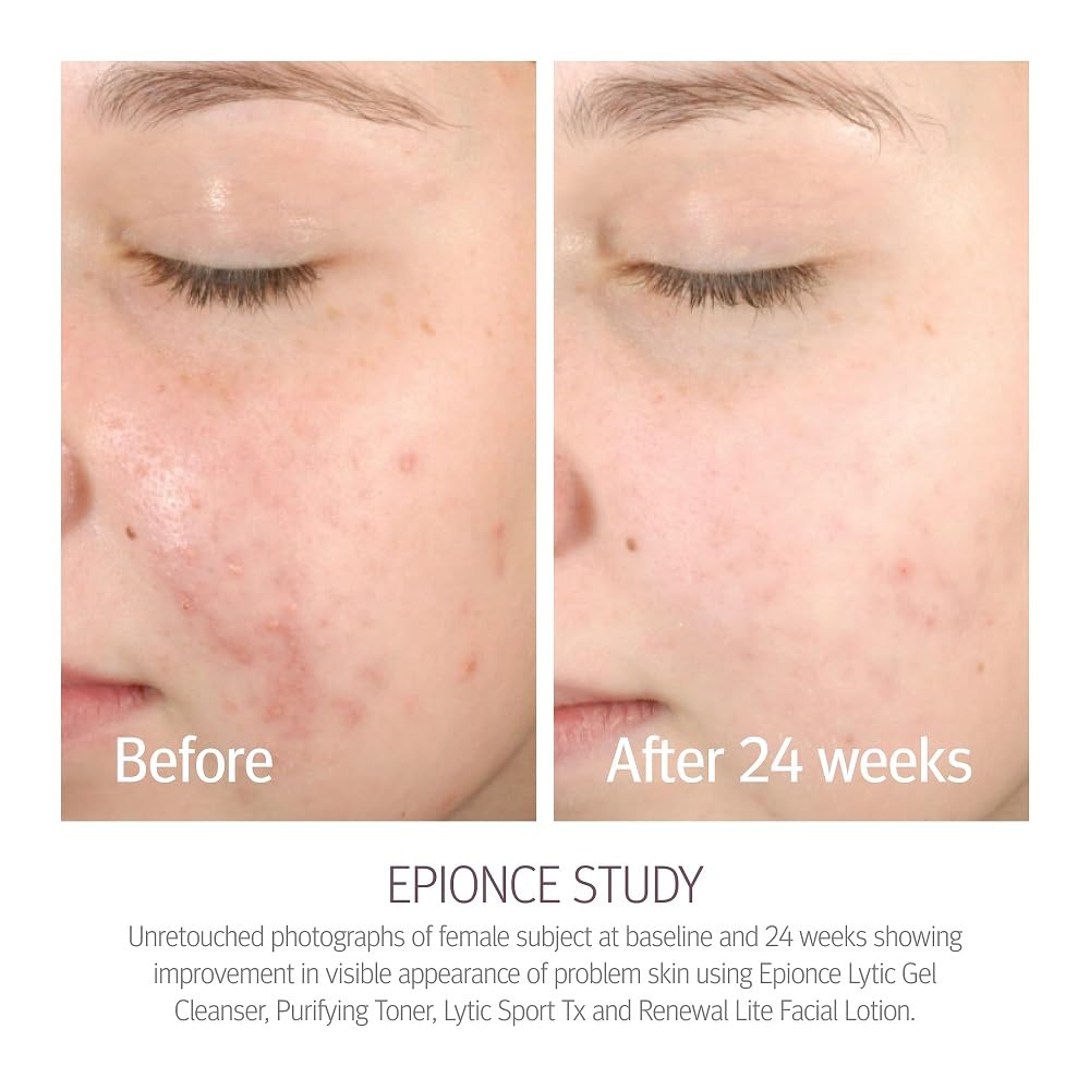 Foto 4 pulgar | Loción Facial Epionce Renewal Lite Hidratante Antienvejecimiento 50 Ml - Venta Internacional.
