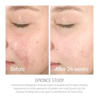 Foto 3 | Loción Facial Epionce Renewal Lite Hidratante Antienvejecimiento 50 Ml - Venta Internacional.