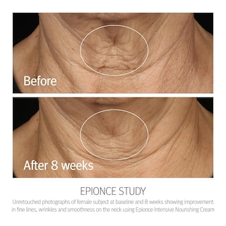 Foto 3 | Crema Epionce Intensiva Nutritiva Antienvejecimiento Para Piel Seca, 50 Ml - Venta Internacional.