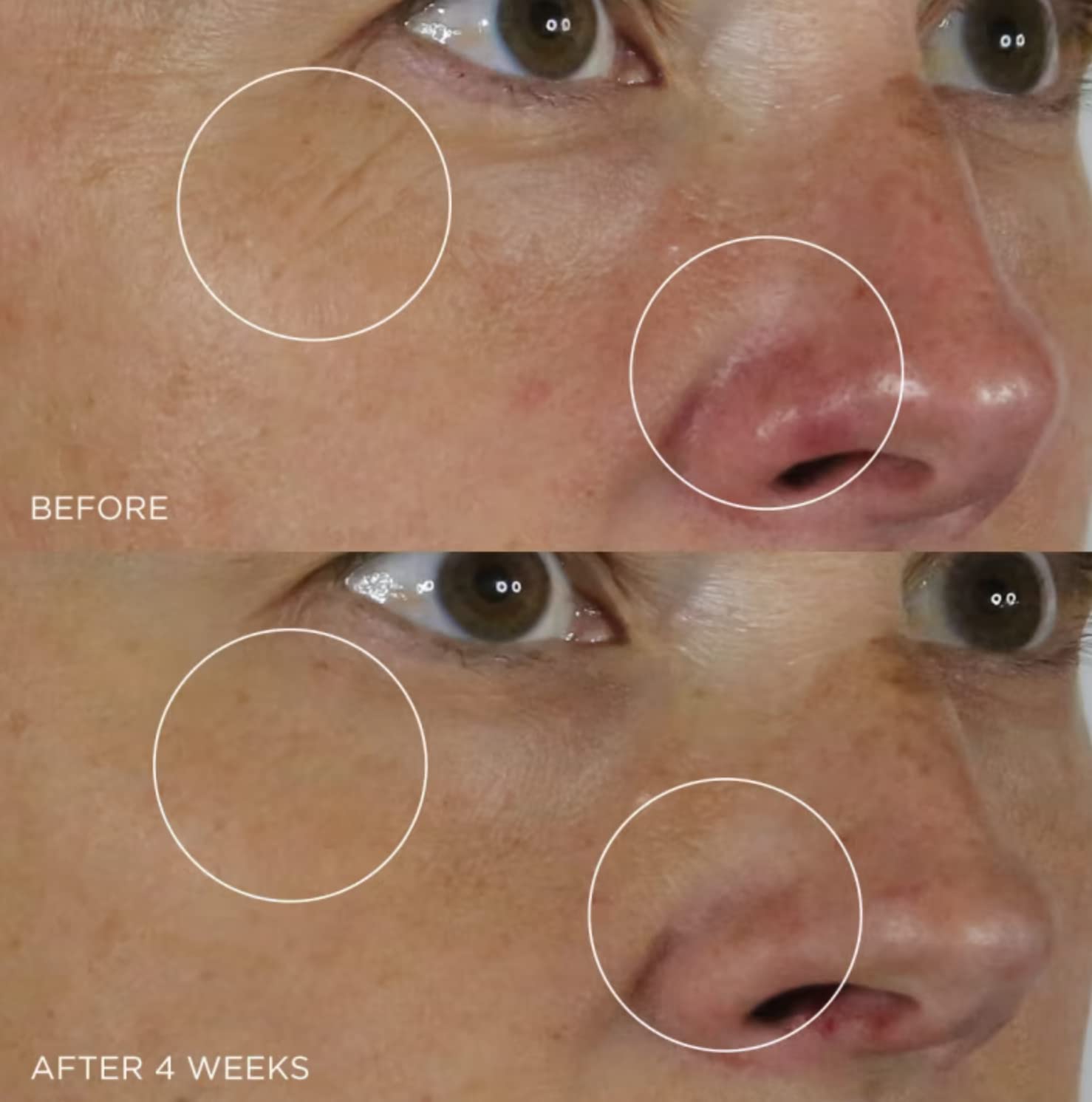 Foto 7 pulgar | Serum Tatcha La Alternativa Al Retinol Suavizante De Arrugas De Seda - Venta Internacional.