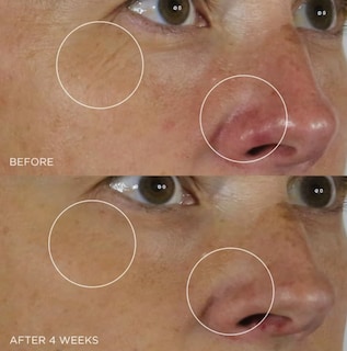 Foto 6 | Serum Tatcha La Alternativa Al Retinol Suavizante De Arrugas De Seda - Venta Internacional.