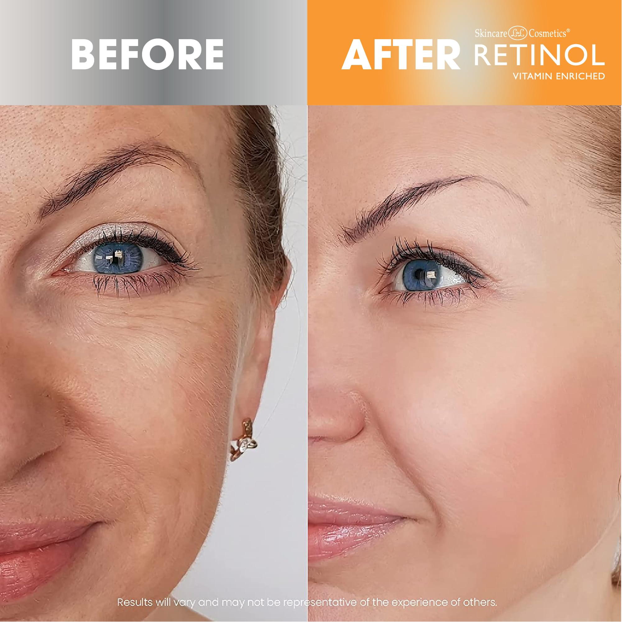 Foto 4 | Hidratante Facial Con Retinol Y Vitamina C - Venta Internacional.