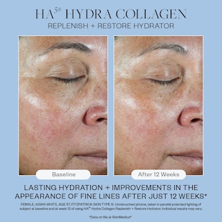 Foto 5 | Hidrator Skinmedica Ha5 Hydra Colágeno Regenerador 60 Ml - Venta Internacional.