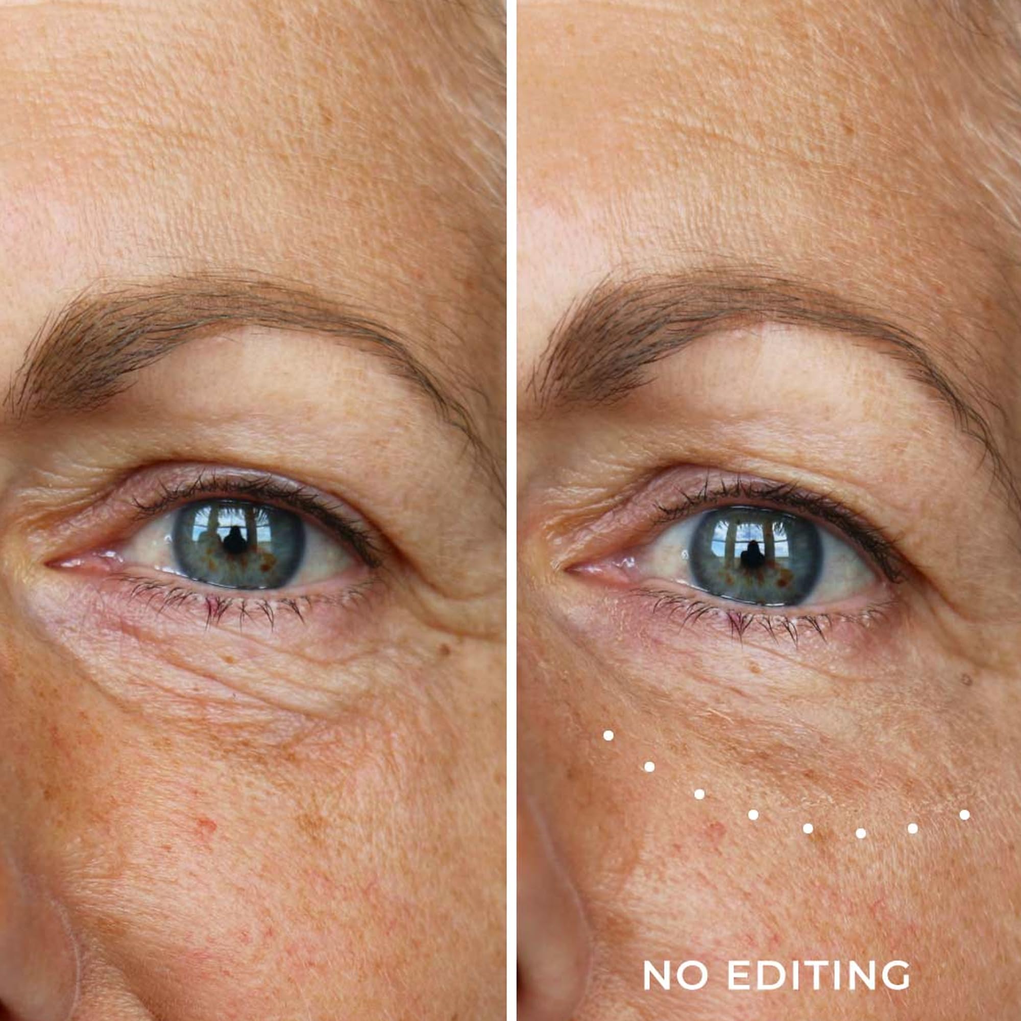 Foto 2 | Crema Reductora De Arrugas En Suero Para Debajo De Los Ojos Wunder2 Wunderlift - Venta Internacional.