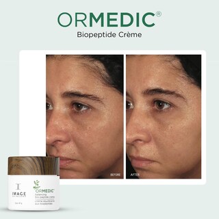 Foto 3 | Crema Hidratante Image Skincare Ormedic Balancing 57 G - Venta Internacional.