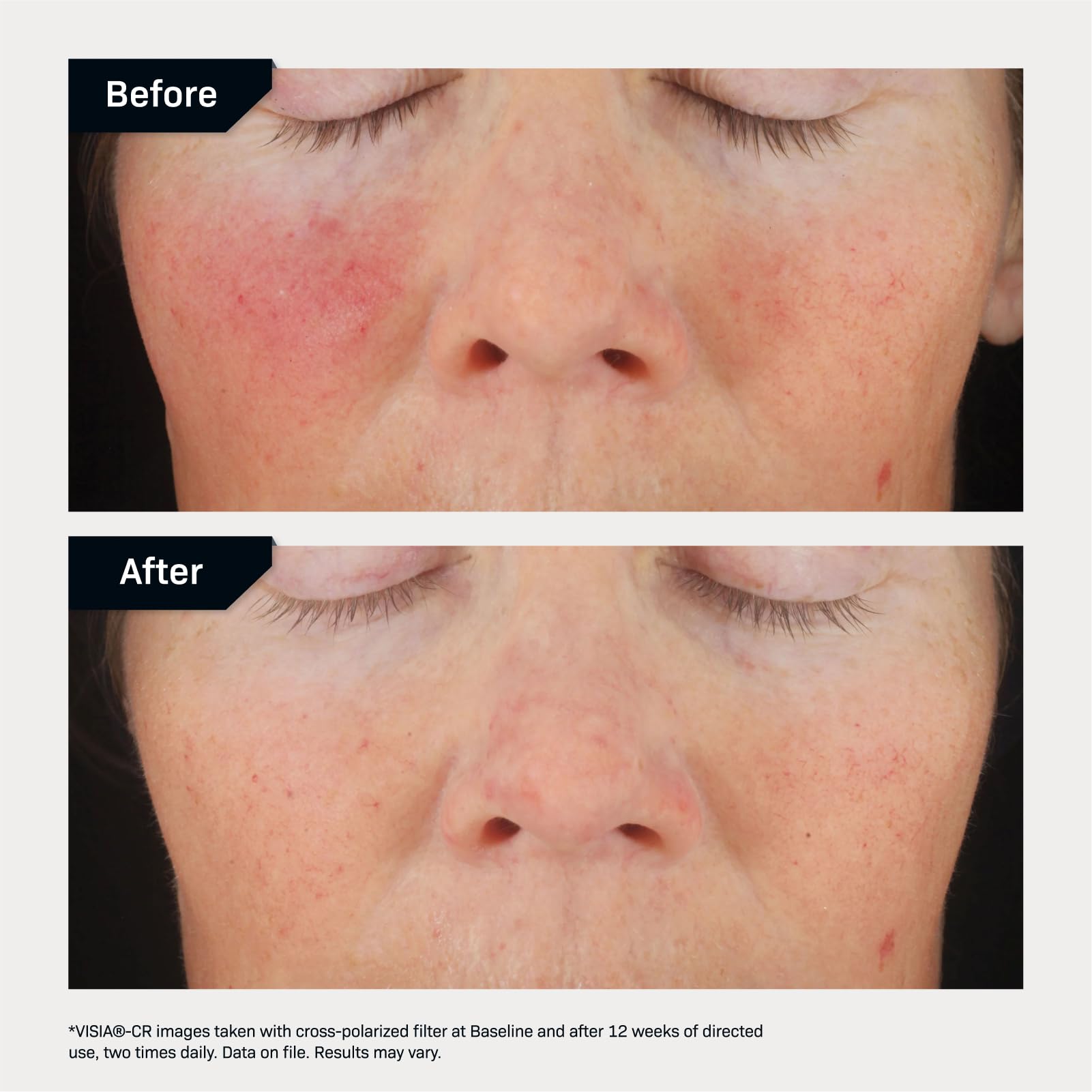 Foto 5 | Complejo Corrector Serum Revision Skincare C+ 30%  15 Ml - Venta Internacional.