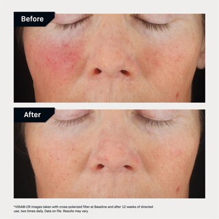 Foto 5 | Complejo Corrector Serum Revision Skincare C+ 30% 15 Ml - Venta Internacional.