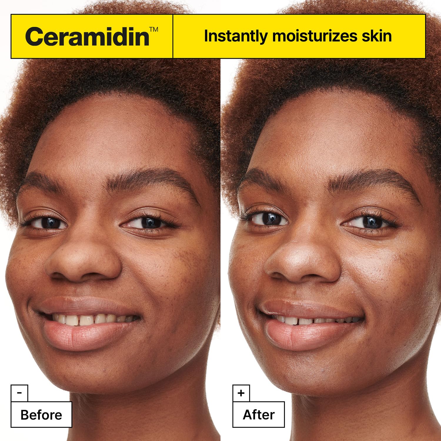 Foto 6 pulgar | Crema Facial Hidratante Dr.jart+ Ceramidin Skin Barrier, 50 Ml - Venta Internacional.