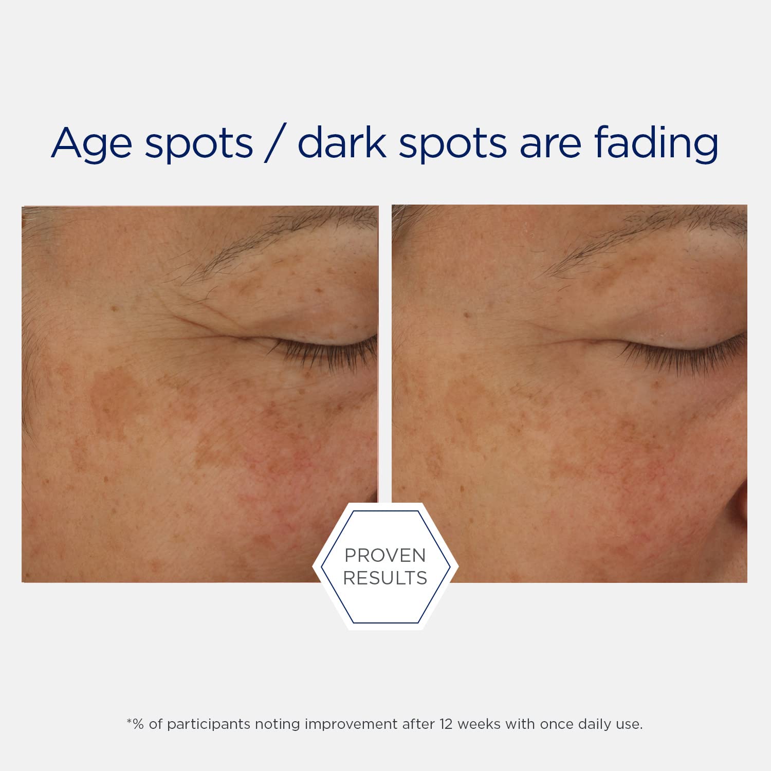 Foto 7 pulgar | Sérum Neostrata Potent Retinol Complex Night 30 Ml - Venta Internacional.