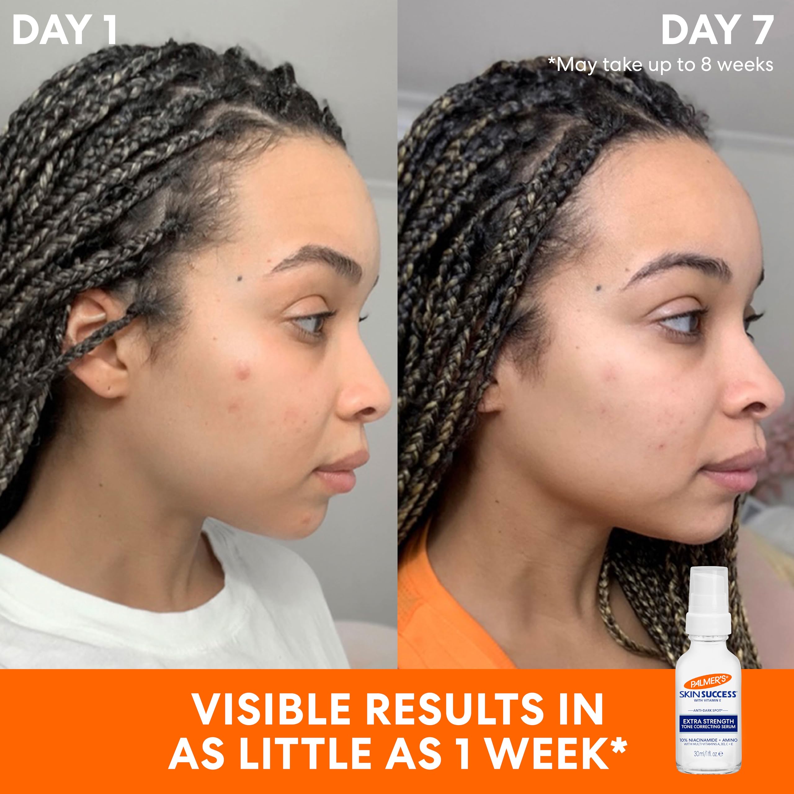 Foto 4 pulgar | Sérum Corrector De Tono Palmer's Skin Success 30 Ml - Venta Internacional.